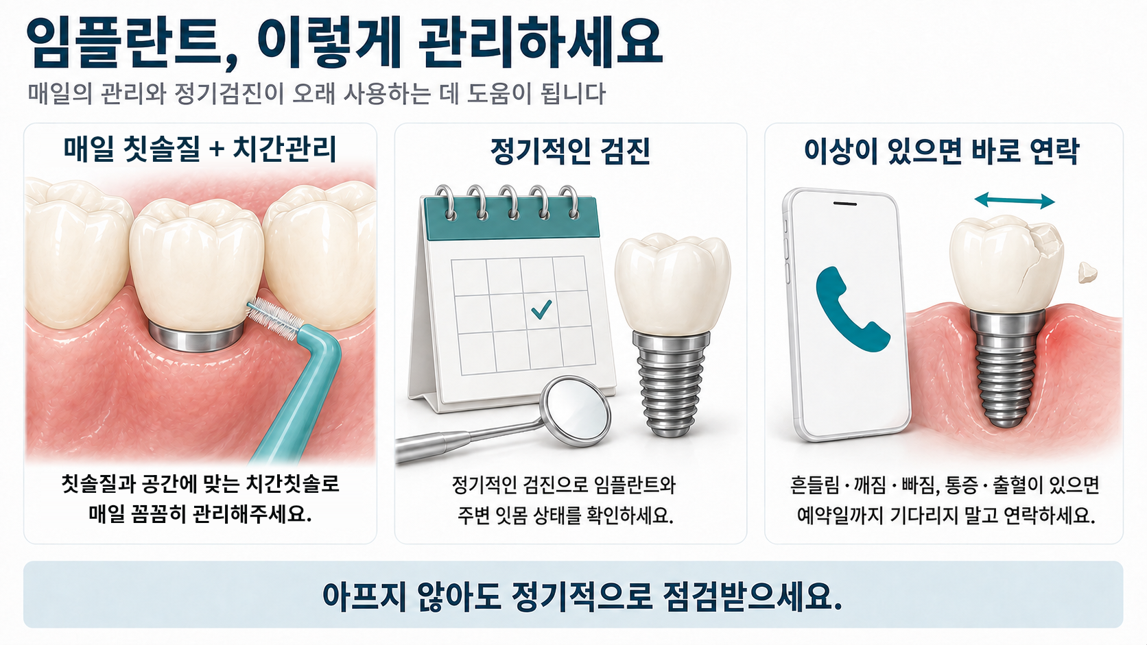 임플란트를 오래 쓰기 위한 관리와 정기검진 설명 이미지