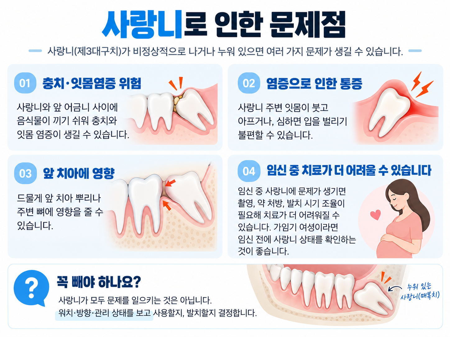 사랑니는 꼭 빼야 할까? 제3대구치의 역할과 발치 기준 설명 이미지