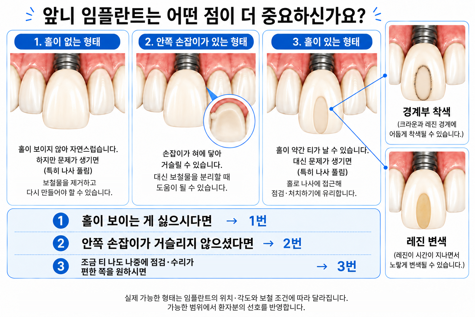 앞니 임플란트 보철의 고정 방식과 심미성 설명 이미지
